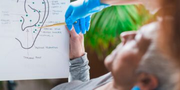 La Auriculoterapia
